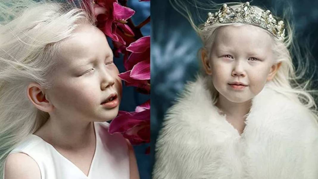 Gözünüz renkliyse dikkat! Büyük sır ortaya çıktı: Meğer o genetik özellik... 5